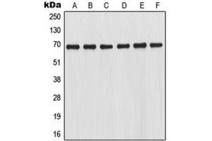 Western blot analysis of NRF2 expression in THP1 (A), HL60 (B), K562 (C), Jurkat (D), mouse kidney (E), rat kidney (F) whole cell lysates. (NRF2 anticorps  (C-Term))