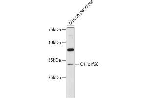 Western blot analysis of extracts of Mouse pancreas, using C11orf68 antibody (ABIN7266371) at 1:1000 dilution. (C11orf68 anticorps  (AA 42-292))