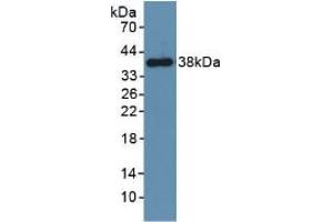 Western blot analysis of recombinant Mouse PDGFRb. (PDGFRB anticorps  (AA 337-583))