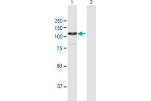 Western Blot analysis of CTNNA2 expression in transfected 293T cell line by CTNNA2 MaxPab polyclonal antibody. (CTNNA2 anticorps  (AA 1-905))