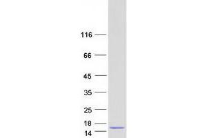 Validation with Western Blot