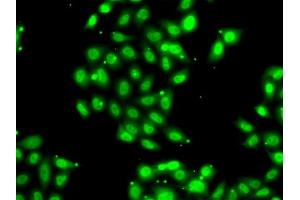 Immunofluorescence analysis of U2OS cells using PI antibody . (PIAS3 anticorps  (AA 399-628))