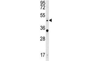 WNT5A antibody western blot analysis in HeLa lysate.
