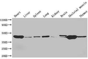 Western Blot Positive WB detected in: Mouse heart tissue, Mouse liver tissue, Mouse spleen tissue, Mouse lung tissue, Mouse kidney tissue, Mouse brain tissue, Mouse skeletal muscle tissue, Mouse thymus tissue All lanes: ACTA1 antibody at 4 μg/mL Secondary Goat polyclonal to rabbit IgG at 1/50000 dilution Predicted band size: 43 kDa Observed band size: 43 kDa (Actin anticorps  (AA 3-377))