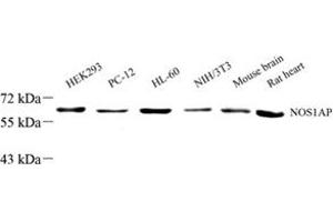 Western blot analysis of NOS1AP (ABIN7074844) at dilution of 1: 1000 (NOS1AP anticorps)