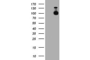 Western Blotting (WB) image for anti-Cadherin 2 (CDH2) antibody (ABIN1499626)
