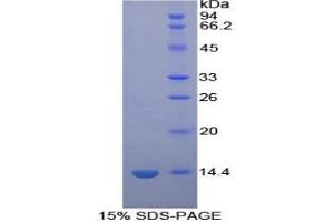 SDS-PAGE of Protein Standard from the Kit (Highly purified E. (PF4 Kit CLIA)