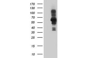 Western Blotting (WB) image for anti-PDZ and LIM Domain 5 (PDLIM5) antibody (ABIN1500131) (PDLIM5 anticorps)