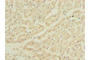 Immunohistochemistry of paraffin-embedded human heart tissue using ABIN7175990 at dilution of 1:100 (ZBTB6 anticorps  (AA 115-424))