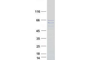 Validation with Western Blot