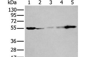 Western blot analysis of 293T A549 A431 Hela and Jurkat cell lysates using PFKFB3 Polyclonal Antibody at dilution of 1:400 (PFKFB3 anticorps)