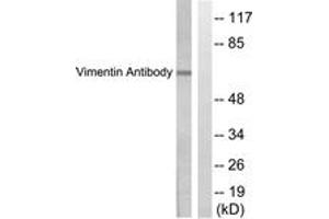 Western blot analysis of extracts from HepG2 cells, treated with Adriamycin 0. (Vimentin anticorps  (AA 411-460))