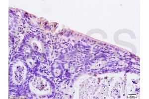 Formalin-fixed and paraffin embedded rat colitis tissue labeled with Anti-PAR-2 Polyclonal Antibody, Unconjugated (ABIN738816) at 1:200 followed by conjugation to the secondary antibody and DAB staining
