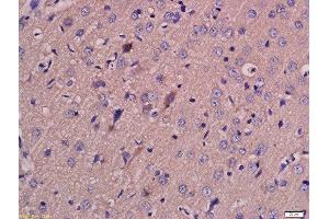 Formalin-fixed and paraffin embedded rat brain labeled with Anti-MCT4 Polyclonal Antibody, Unconjugated  at 1:200 followed by conjugation to the secondary antibody and DAB staining. (SLC16A3 anticorps  (AA 401-465))