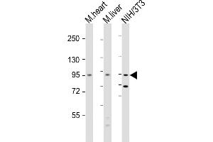 All lanes : Anti-Insr Antibody  at 1:2000 dilution Lane 1: mouse heart lysate Lane 2: mouse liver lysate Lane 3: NIH/3T3 whole cell lysate Lysates/proteins at 20 μg per lane.