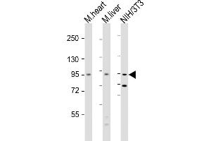 All lanes : Anti-Insr Antibody  at 1:2000 dilution Lane 1: mouse heart lysate Lane 2: mouse liver lysate Lane 3: NIH/3T3 whole cell lysate Lysates/proteins at 20 μg per lane. (Insulin Receptor anticorps  (AA 1325-1358))