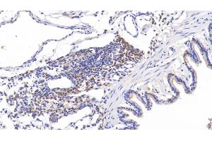 Detection of TNC in Rat Lung Tissue using Polyclonal Antibody to Tenascin C (TNC)