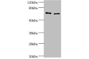 Western blot All lanes: Protein-glutamine gamma-glutamyltransferase 2 antibody at 8 μg/mL Lane 1: Hela whole cell lysate Lane 2: HepG2 whole cell lysate Secondary Goat polyclonal to rabbit IgG at 1/10000 dilution Predicted band size: 78, 62, 39 kDa Observed band size: 78 kDa (Transglutaminase 2 anticorps  (AA 438-687))