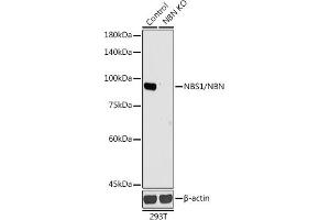 Western blot analysis of extracts from normal (control) and NBS1/NBS1/NBN knockout (KO) 293T cells, using NBS1/NBS1/NBN antibody (ABIN1681204, ABIN3015326, ABIN3015327 and ABIN5663771) at 1:1000 dilution.