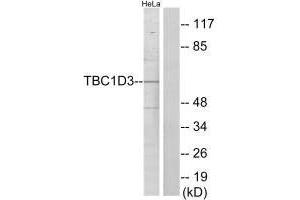 Western blot analysis of extracts from HeLa cells, using TBC1D3 antibody. (TBC1D3 anticorps)