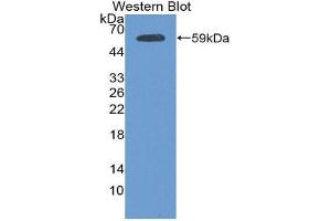 Western Blotting (WB) image for anti-Plakophilin 1 (PKP1) (AA 500-742) antibody (ABIN1869831)