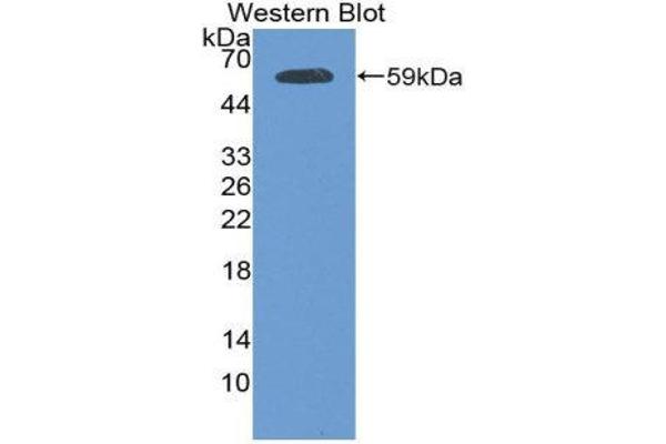 Plakophilin 1 anticorps  (AA 500-742)