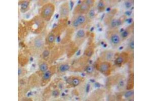 Used in DAB staining on fromalin fixed paraffin-embedded Liver tissue (MBL2 anticorps  (AA 129-244))