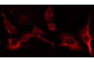 ABIN6266922 staining HT29 cells by IF/ICC. (CYP2B6 anticorps)