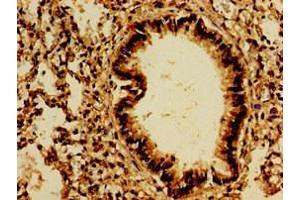 Immunohistochemistry of paraffin-embedded human lung tissue using ABIN7167505 at dilution of 1:100