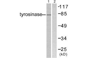 Western Blotting (WB) image for anti-Tyrosinase (TYR) (C-Term) antibody (ABIN1848870) (TYR anticorps  (C-Term))