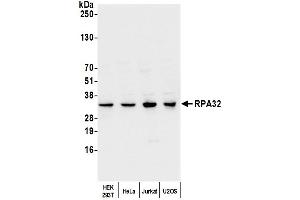 Western Blotting (WB) image for anti-Replication Protein A2, 32kDa (RPA2) (C-Term) antibody (ABIN7454599) (RPA2 anticorps  (C-Term))