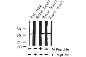 Western blot analysis of Phospho-EFNB1/2 (Tyr330) expression in various lysates (Ephrin B2 anticorps  (pTyr330))