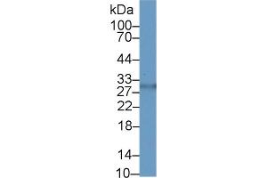 Detection of ASGR2 in Human Urine using Polyclonal Antibody to Asialoglycoprotein Receptor 2 (ASGR2)