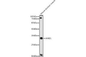 Western blot analysis of extracts of Mouse skeletal muscle, using  antibody (ABIN7265464) at 1:1000 dilution.