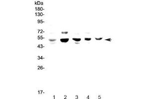 Western blot testing of 1) human HeLa, 2) rat PC-12, 3) mouse lung, 4) mouse ovary and 5) mouse HEPA1-6 lysate with NFIB antibody at 0.