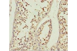 Immunohistochemistry of paraffin-embedded human testis tissue using ABIN7144897 at dilution of 1:100 (ABCB8 anticorps  (AA 486-735))