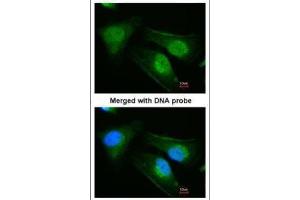 ICC/IF Image Immunofluorescence analysis of paraformaldehyde-fixed HeLa, using DNAJB6, antibody at 1:200 dilution.