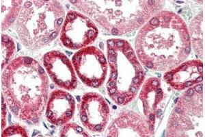 Human Kidney (formalin-fixed, paraffin-embedded) stained with BECN1 antibody ABIN461895 at 5 ug/ml followed by biotinylated goat anti-rabbit IgG secondary antibody ABIN481713, alkaline phosphatase-streptavidin and chromogen. (Beclin 1 anticorps  (N-Term))