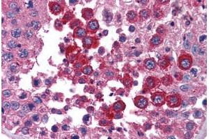 Human Testis (formalin-fixed, paraffin-embedded) stained with STAT4 antibody ABIN239852 at 1:50 followed by biotinylated goat anti-rabbit IgG secondary antibody ABIN481713, alkaline phosphatase-streptavidin and chromogen. (STAT4 anticorps  (N-Term))