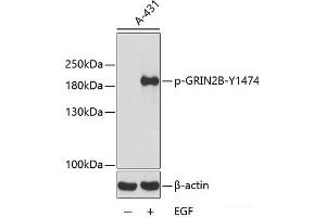 Western blot analysis of extracts from A431 cells using Phospho-GRIN2B(Y1474) Polyclonal Antibody. (GRIN2B anticorps  (pTyr1474))
