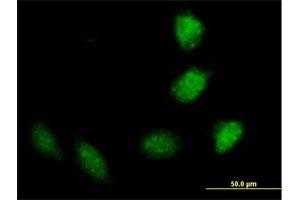 Immunofluorescence of purified MaxPab antibody to TRIM40 on HeLa cell.