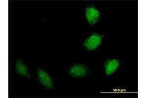 Immunofluorescence of purified MaxPab antibody to TRIM40 on HeLa cell. (TRIM40 anticorps  (AA 1-258))