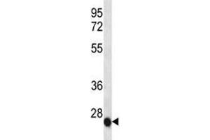 IL-6 antibody western blot analysis in NCI-H460 lysate