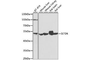 Western blot analysis of extracts of various cell lines, using SETD6 antibody (ABIN4905136) at 1:1000 dilution. (SETD6 anticorps)