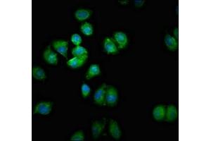 Immunofluorescent analysis of A549 cells using ABIN7170545 at dilution of 1:100 and Alexa Fluor 488-congugated AffiniPure Goat Anti-Rabbit IgG(H+L)