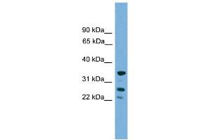 WB Suggested Anti-H1FOO Antibody Titration: 0. (H1FOO anticorps  (Middle Region))