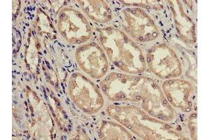 Immunohistochemistry of paraffin-embedded human kidney tissue using ABIN7143187 at dilution of 1:100 (ACAD11 anticorps  (AA 225-388))