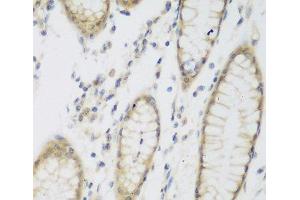 Immunohistochemistry of paraffin-embedded Human stomach using NAT8B Polyclonal Antibody at dilution of 1:200 (40x lens). (NAT8B anticorps)