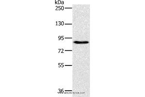 Western blot analysis of 231 cell, using PLEKHG6 Polyclonal Antibody at dilution of 1:800 (PLEKHG6 anticorps)