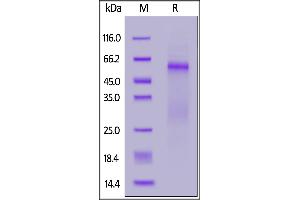SARS-CoV-2 Nucleocapsid protein, His Tag on  under reducing (R) condition.